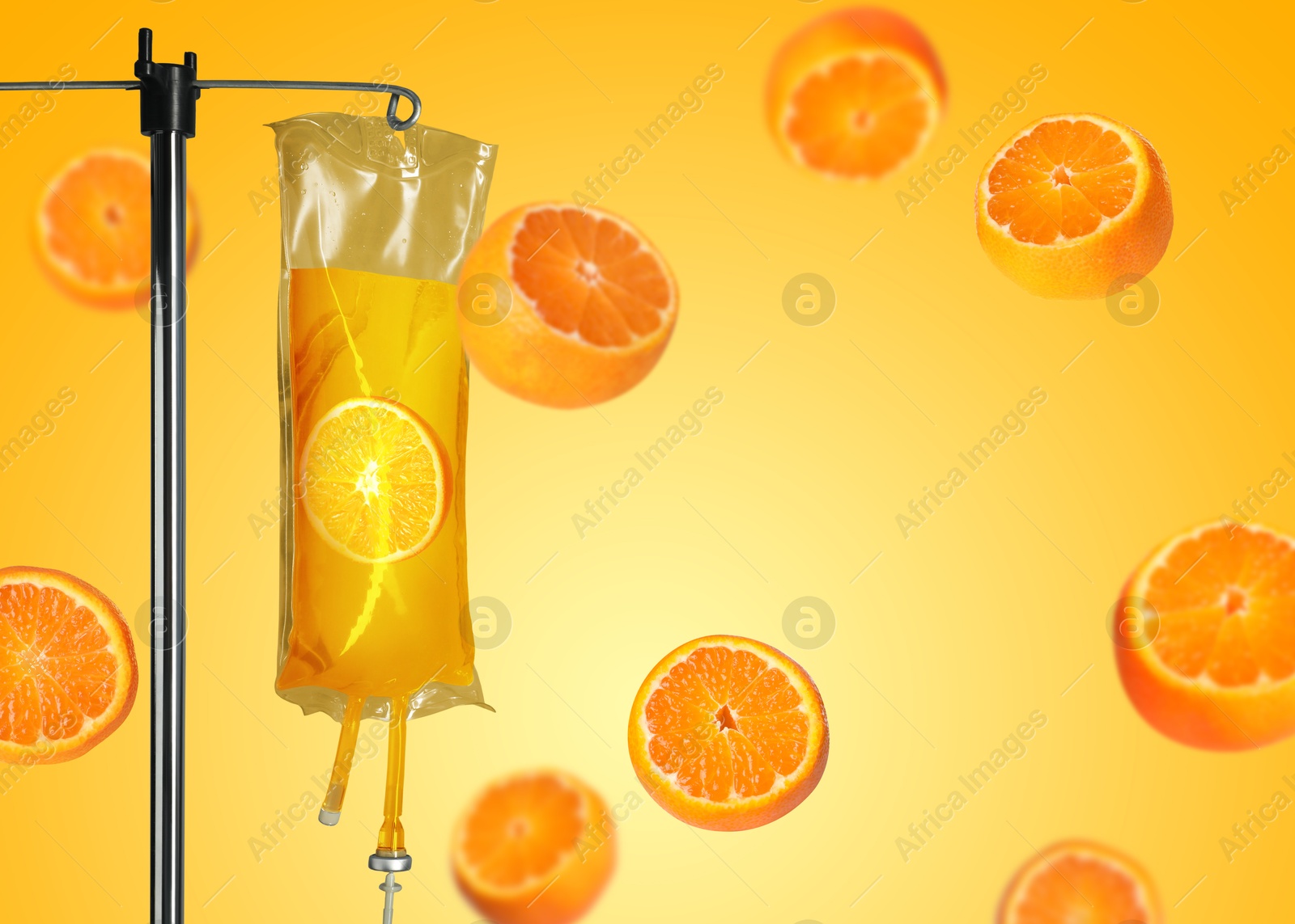 Image of Vitamin intravenous therapy. IV infusion set and falling oranges on golden background