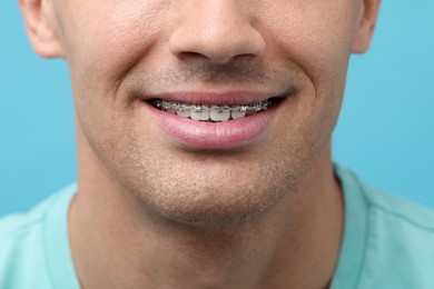 Photo of Smiling man with dental braces on light blue background, closeup