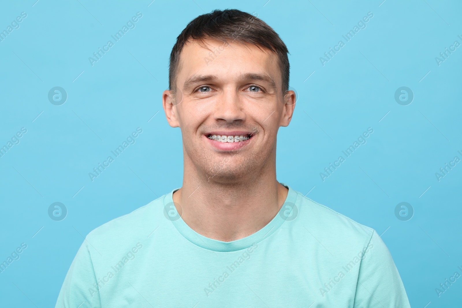 Photo of Smiling man with dental braces on light blue background