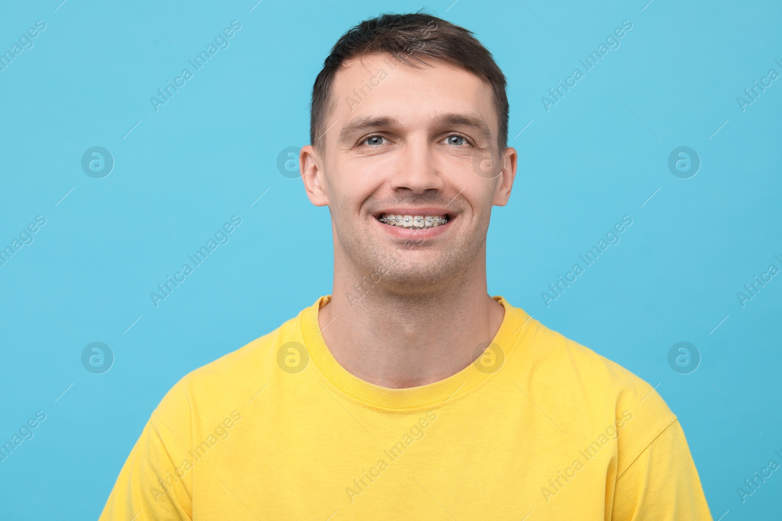 Photo of Smiling man with dental braces on light blue background