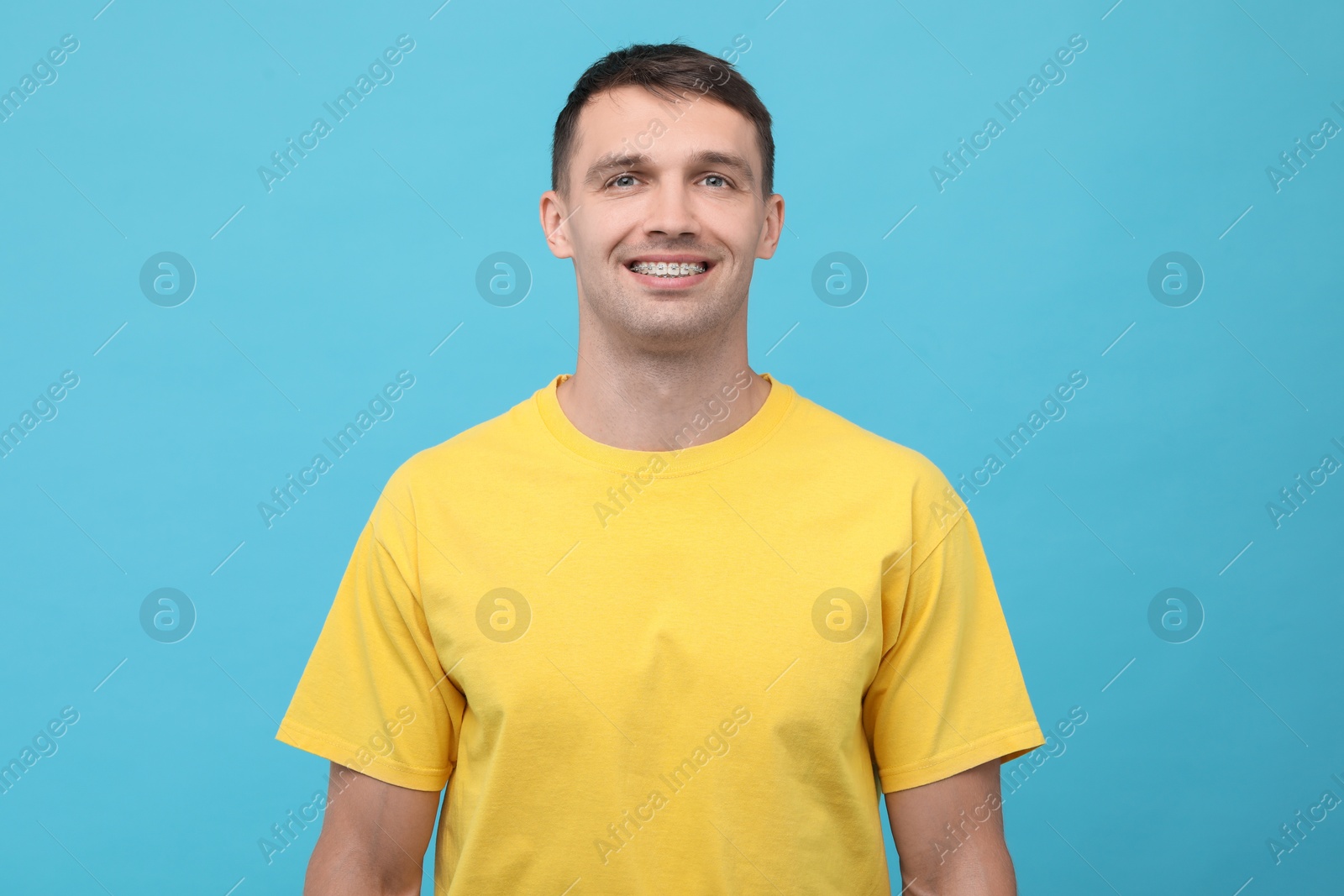 Photo of Smiling man with dental braces on light blue background