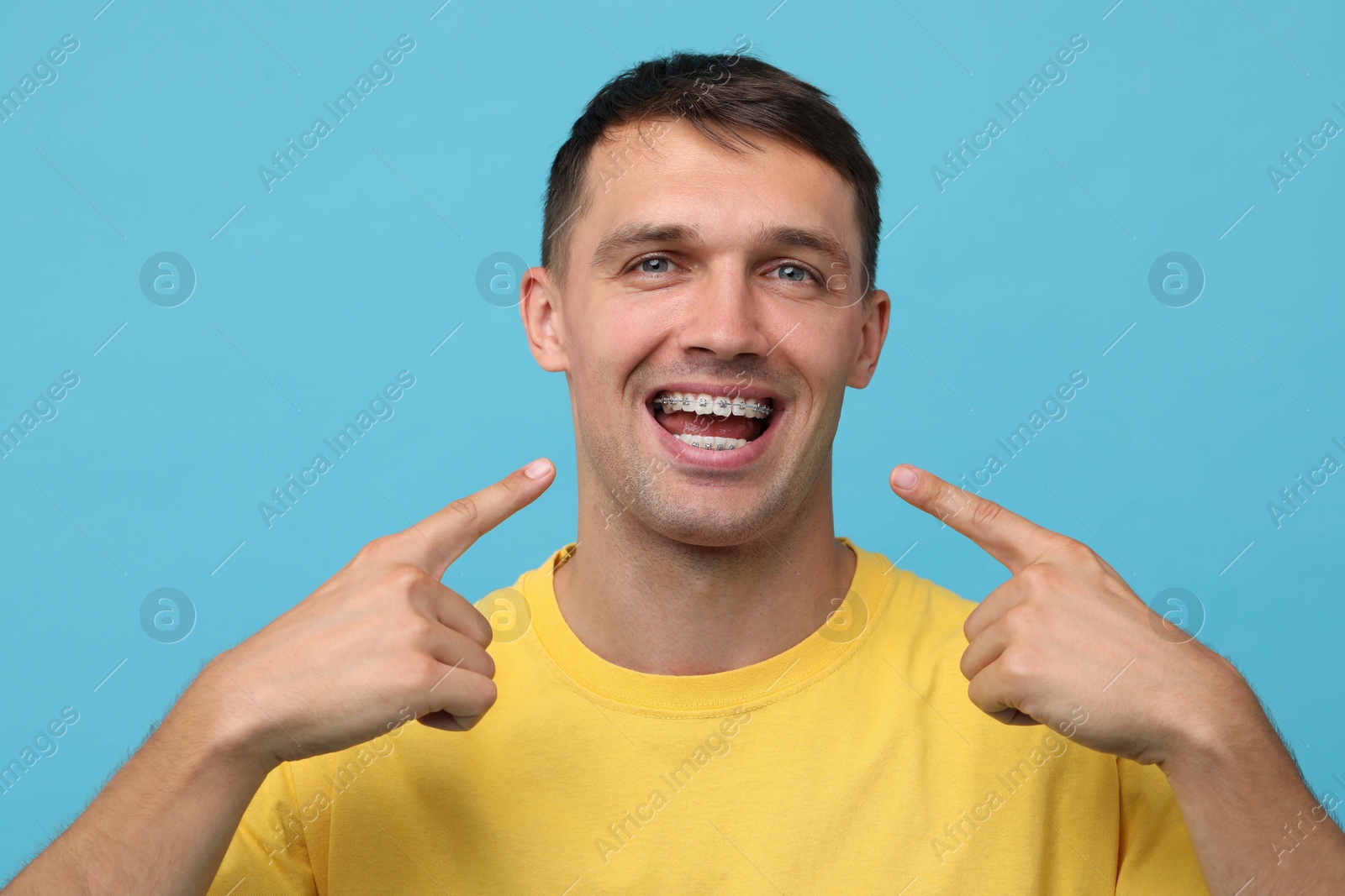 Photo of Happy man pointing at his dental braces on light blue background