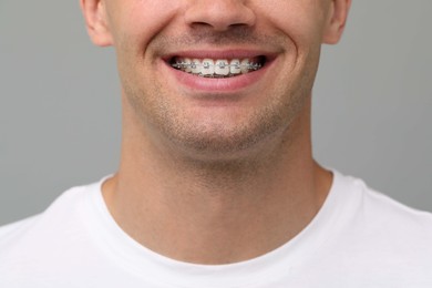 Smiling man with dental braces on grey background, closeup