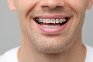 Smiling man with dental braces on grey background, closeup