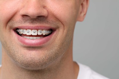 Photo of Smiling man with dental braces on grey background, closeup