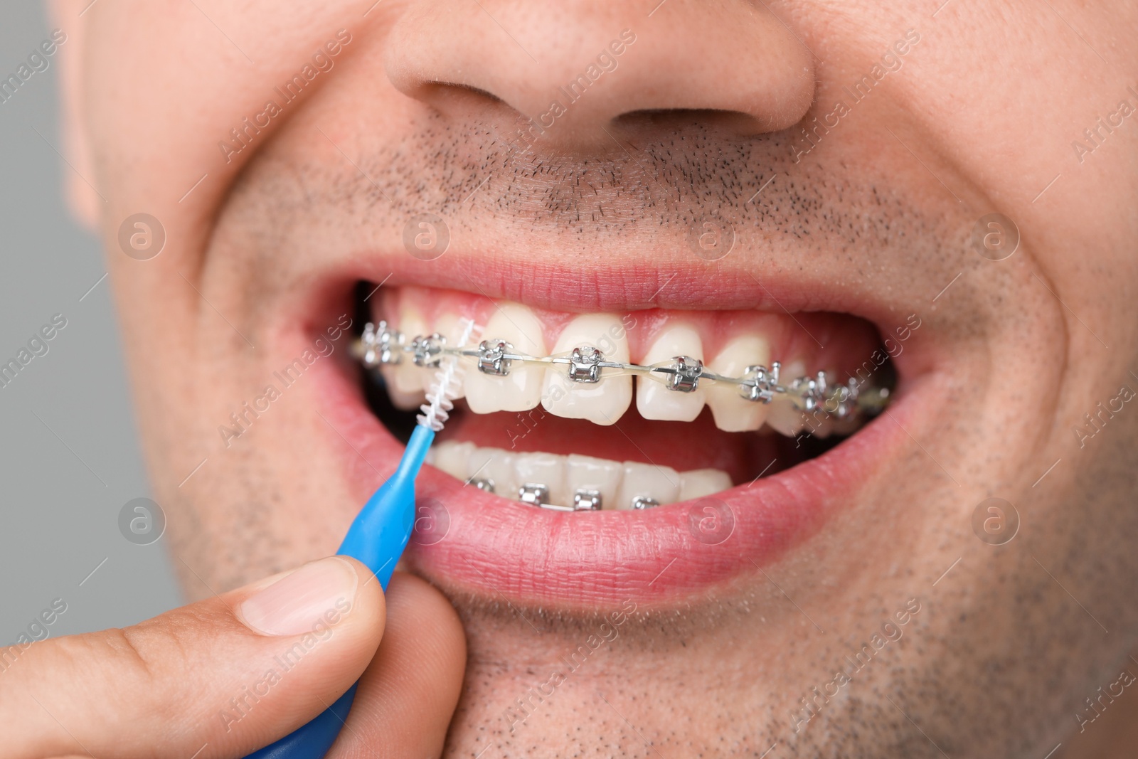 Photo of Man with dental braces cleaning teeth using interdental brush on grey background, closeup