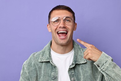 Photo of Happy man pointing at his dental braces on violet background