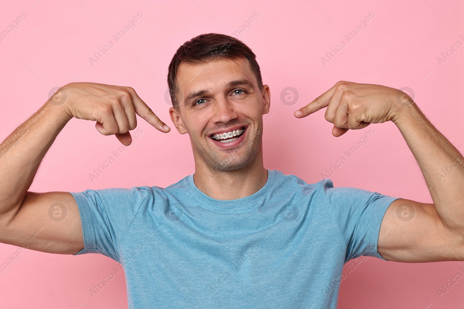 Photo of Happy man pointing at his dental braces on pink background