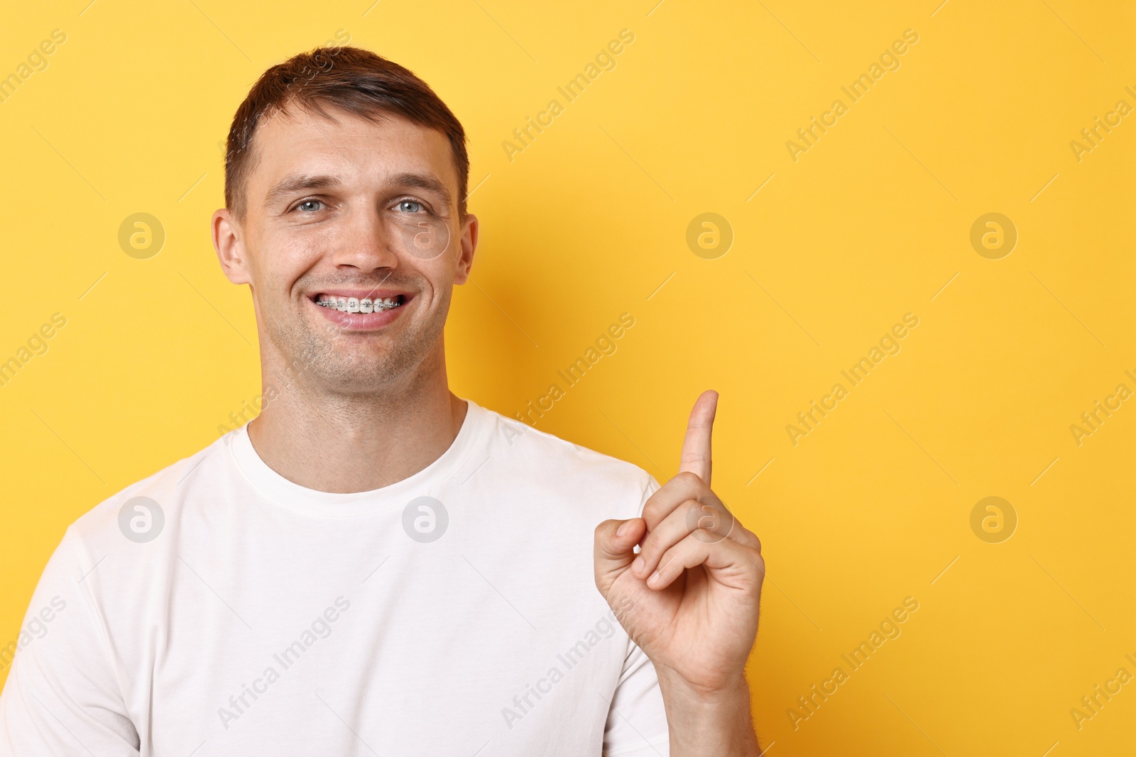 Photo of Smiling man with dental braces pointing at something on yellow background. Space for text