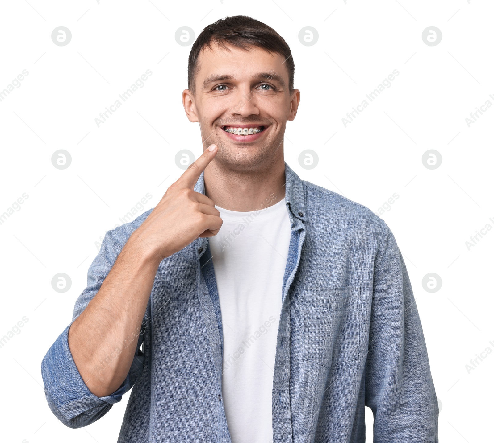 Photo of Smiling man pointing at his dental braces on white background