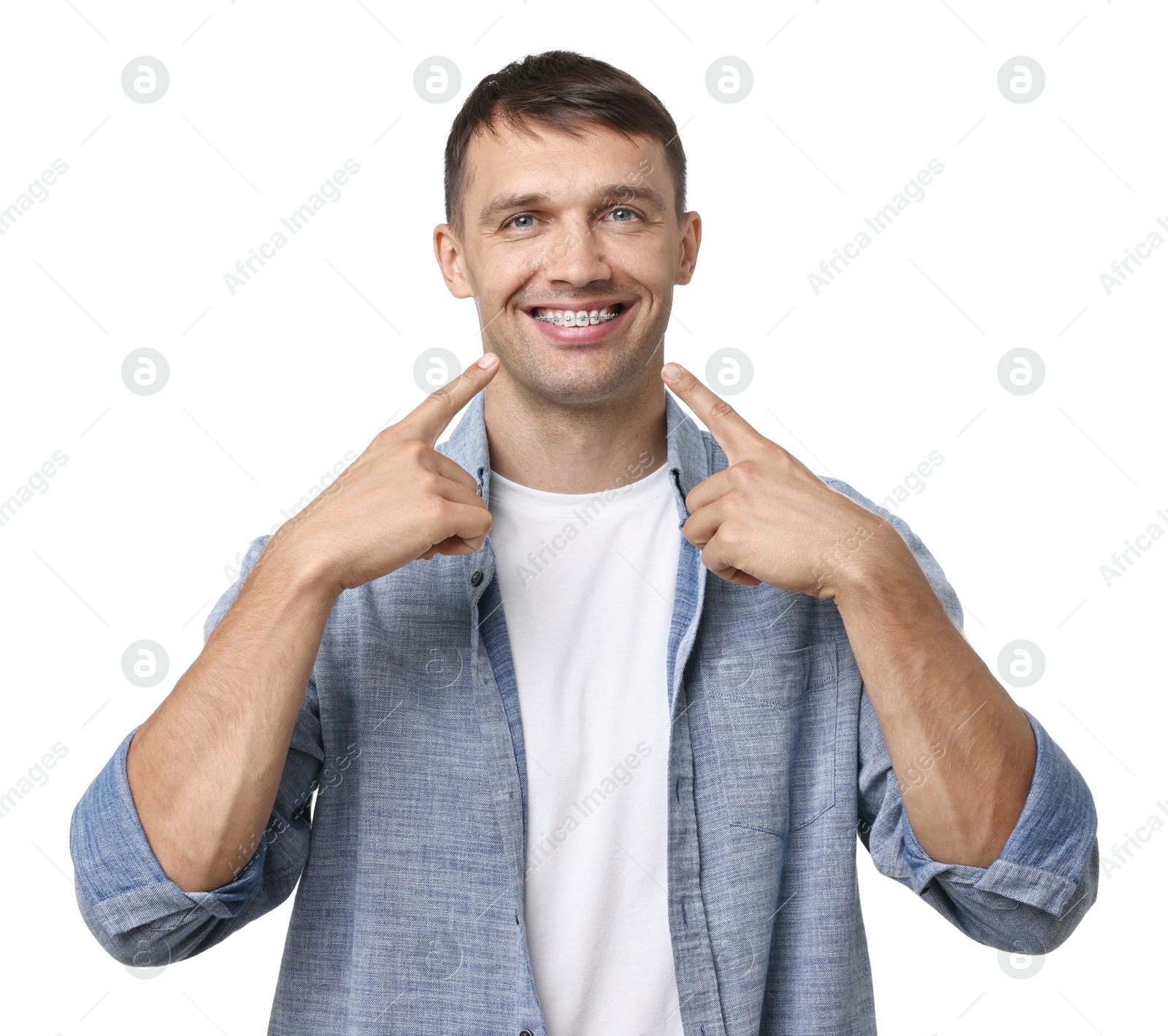 Photo of Smiling man pointing at his dental braces on white background