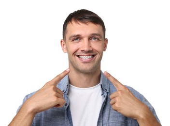 Smiling man pointing at his dental braces on white background