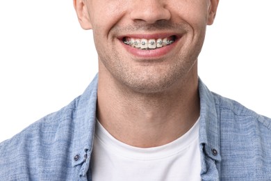 Smiling man with dental braces on white background, closeup