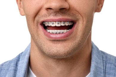 Happy man with dental braces on white background, closeup