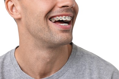 Happy man with dental braces on white background, closeup