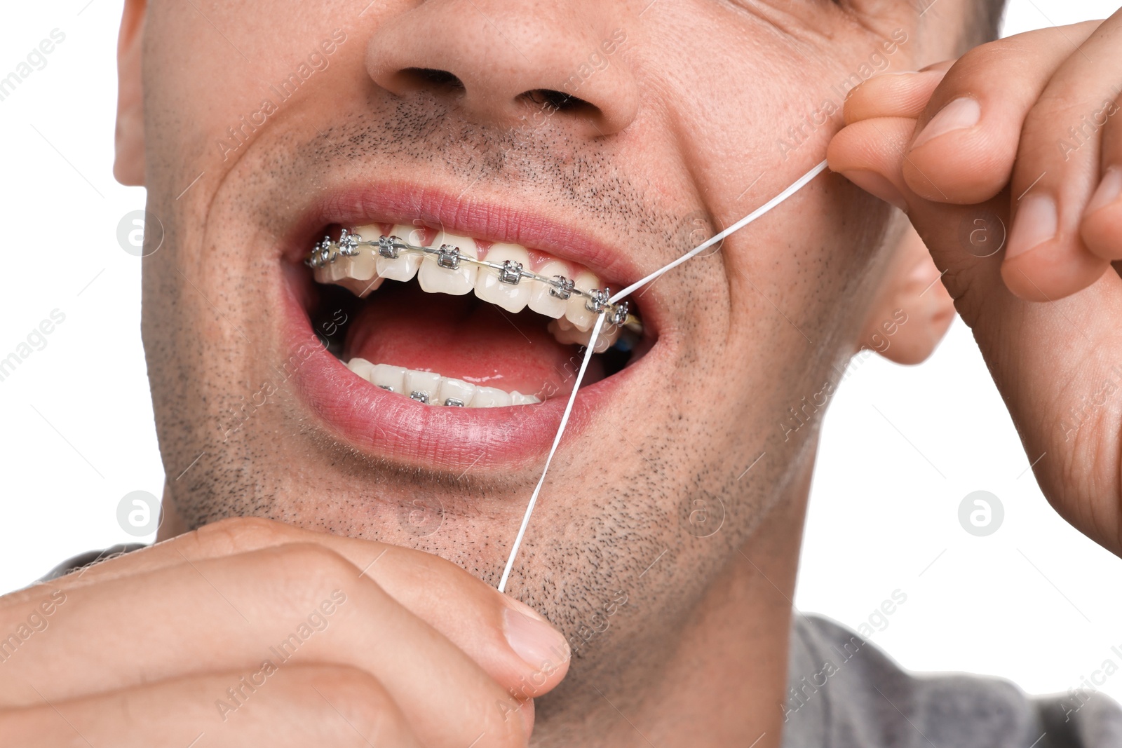 Photo of Man with braces cleaning teeth using dental floss on white background, closeup