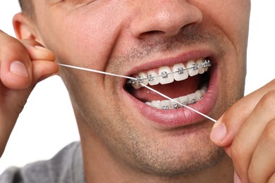 Photo of Man with braces cleaning teeth using dental floss on white background, closeup