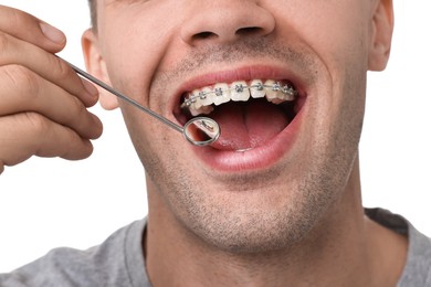 Examination of man's teeth with braces using mirror tool on white background, closeup