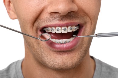 Photo of Examination of man's teeth with braces using dental tools on white background, closeup