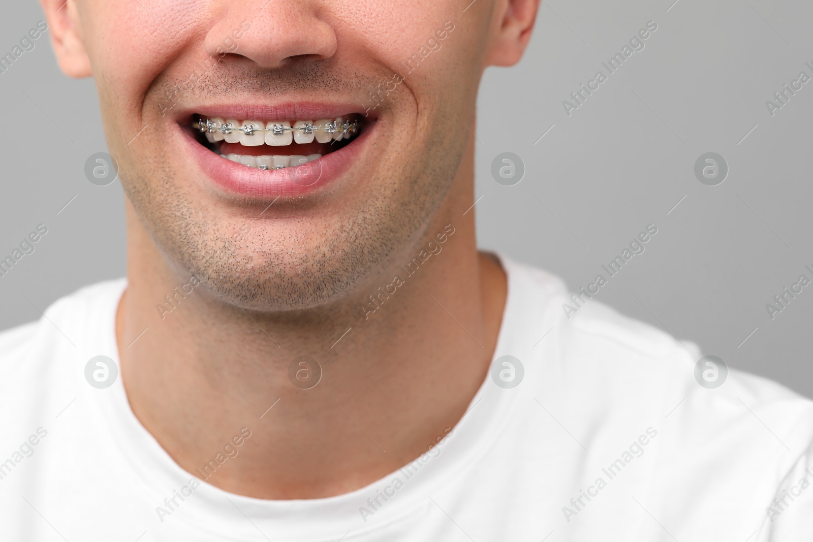 Photo of Smiling man with dental braces on grey background, closeup