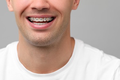 Smiling man with dental braces on grey background, closeup