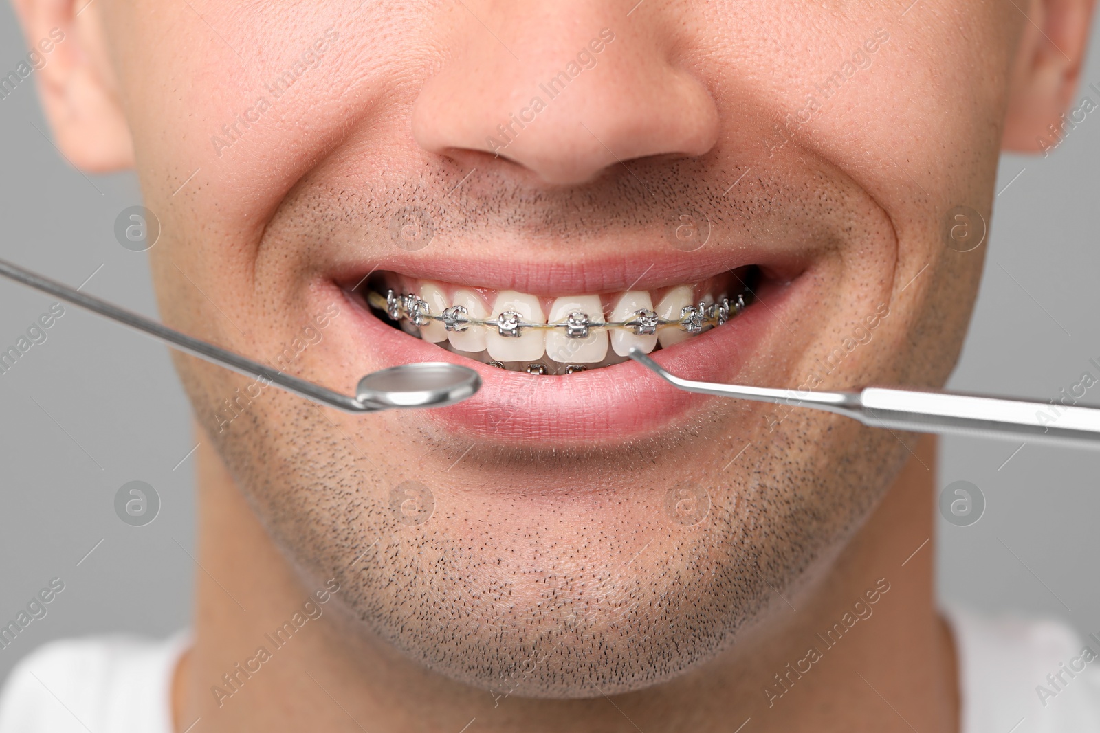 Photo of Examination of man's teeth with braces using dental tools on grey background, closeup