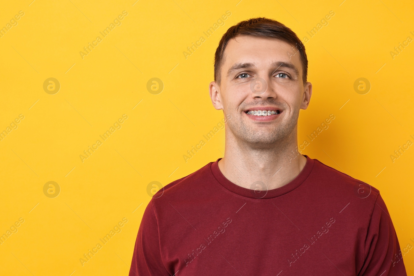 Photo of Smiling man with dental braces on yellow background. Space for text