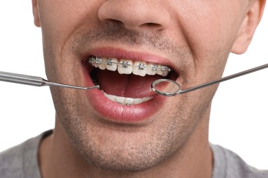 Photo of Examination of man's teeth with braces using dental tools on white background, closeup