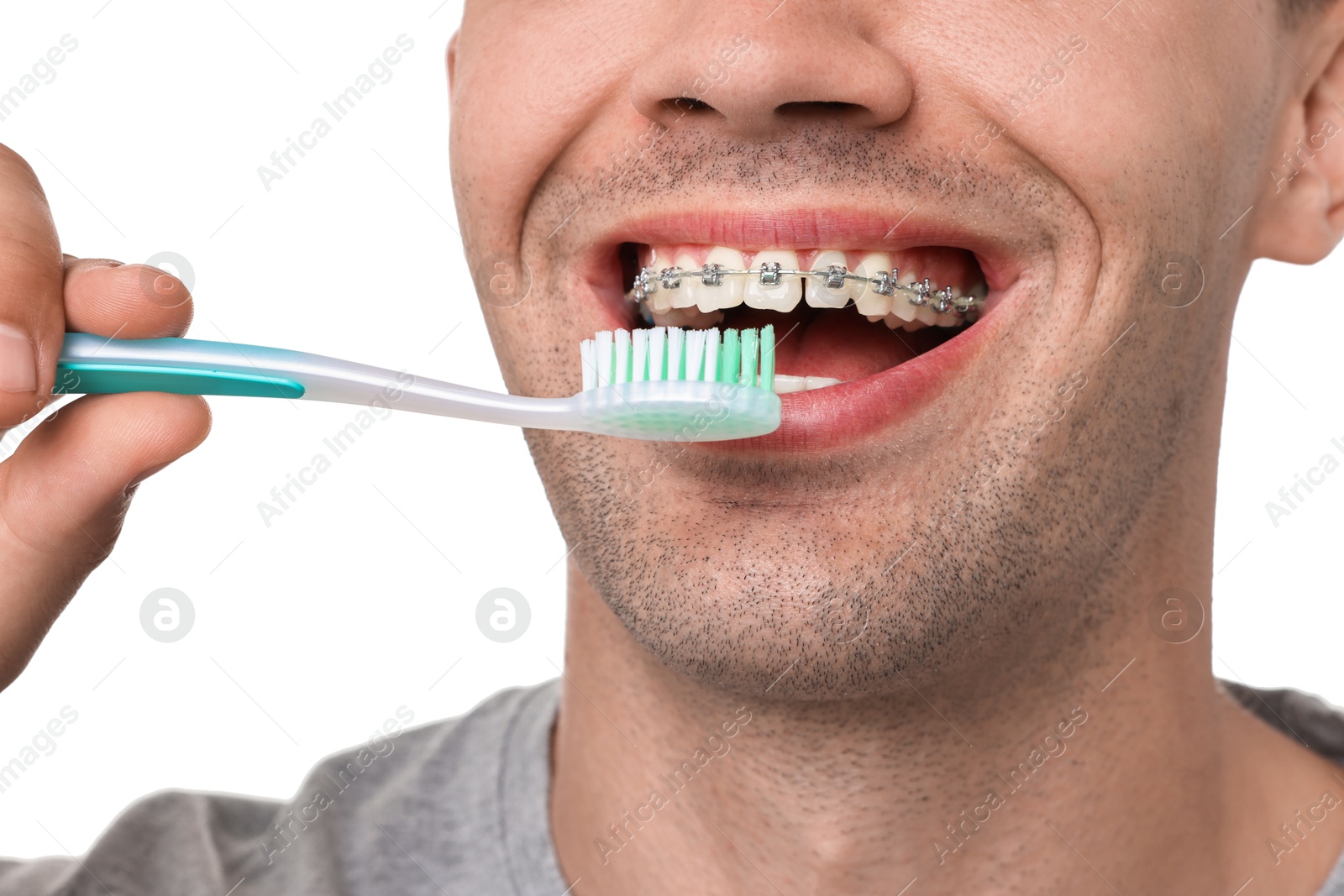 Photo of Man with dental braces cleaning teeth on white background, closeup