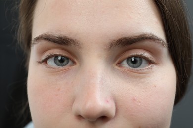 Photo of Closeup view of young woman with beautiful blue eyes on grey background