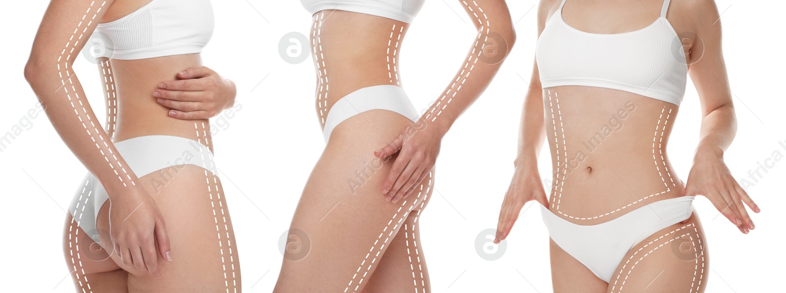 Image of Beautiful woman with perfect slim body posing on white background, collage. Lines on skin repeating figure