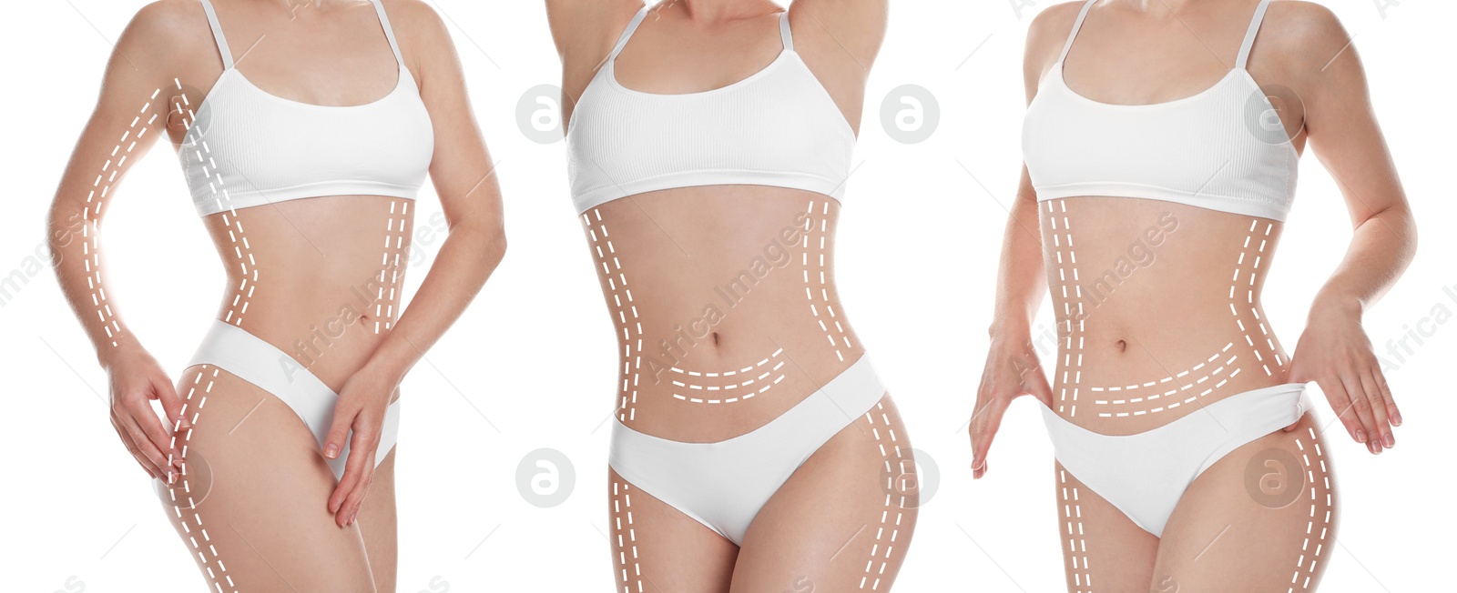 Image of Beautiful woman with perfect slim body posing on white background, collage. Lines on skin repeating figure