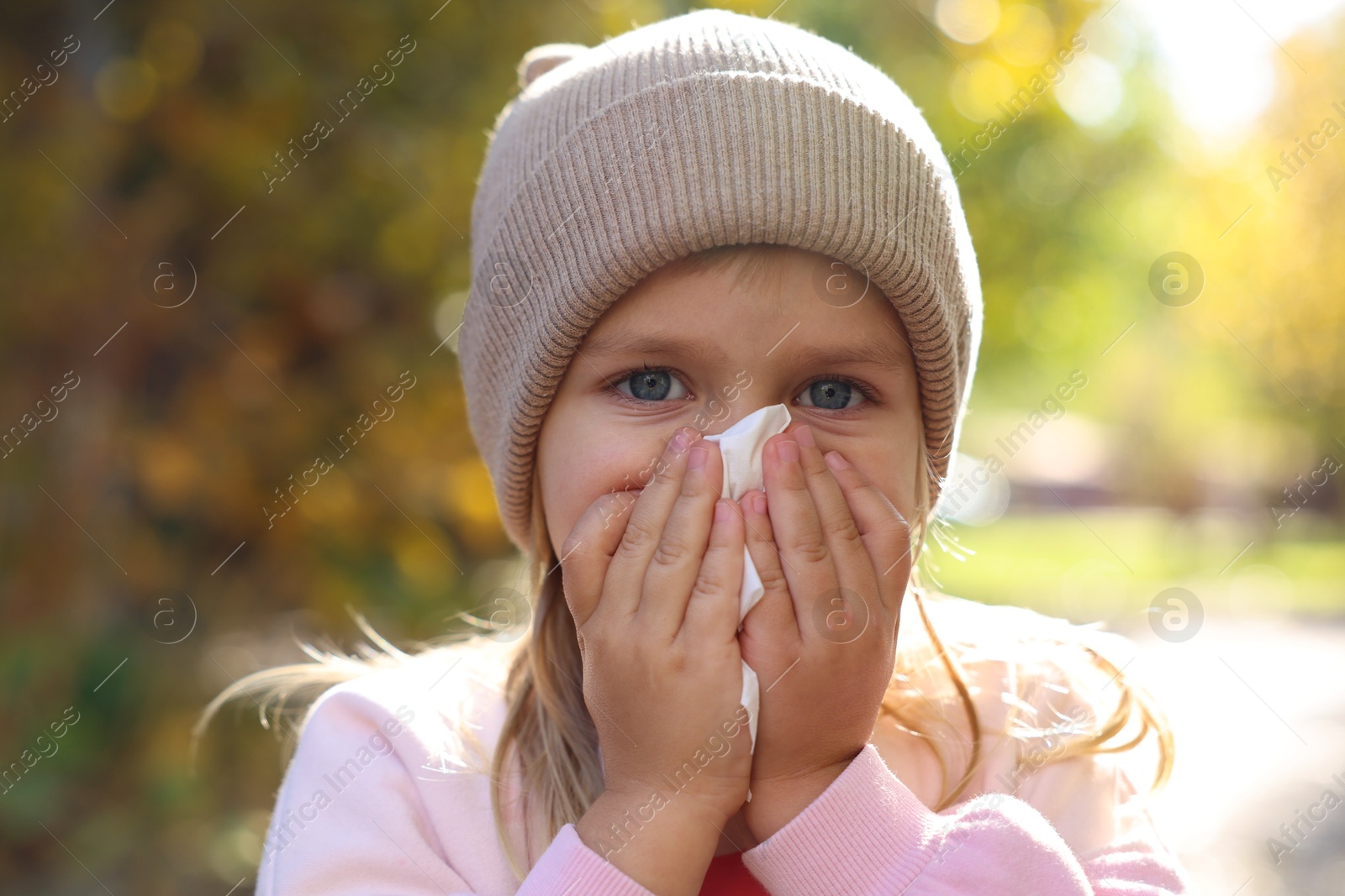 Photo of Little girl with runny nose in park