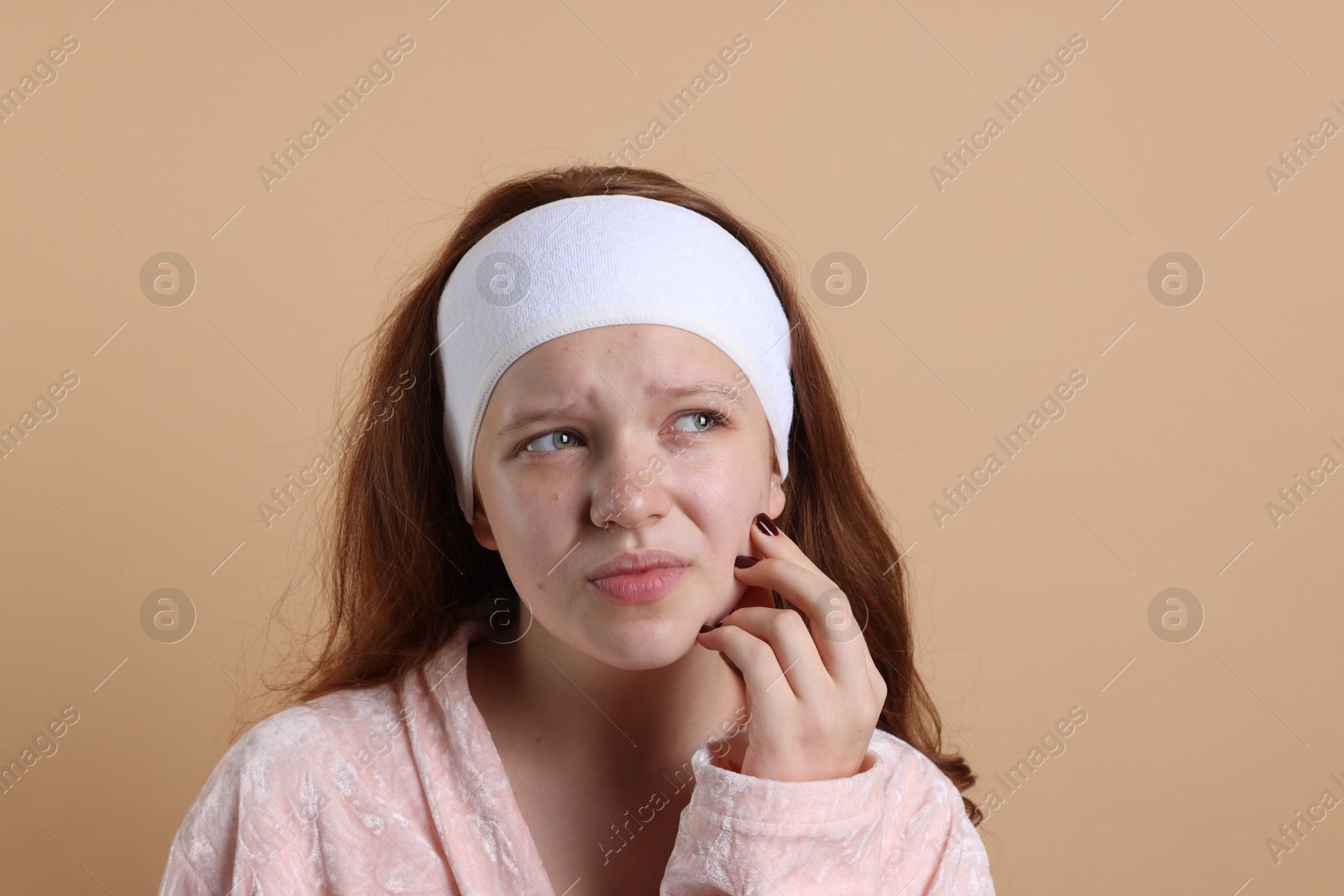 Photo of Teenage girl suffering from acne against beige background