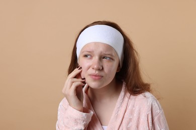 Photo of Teenage girl suffering from acne against beige background