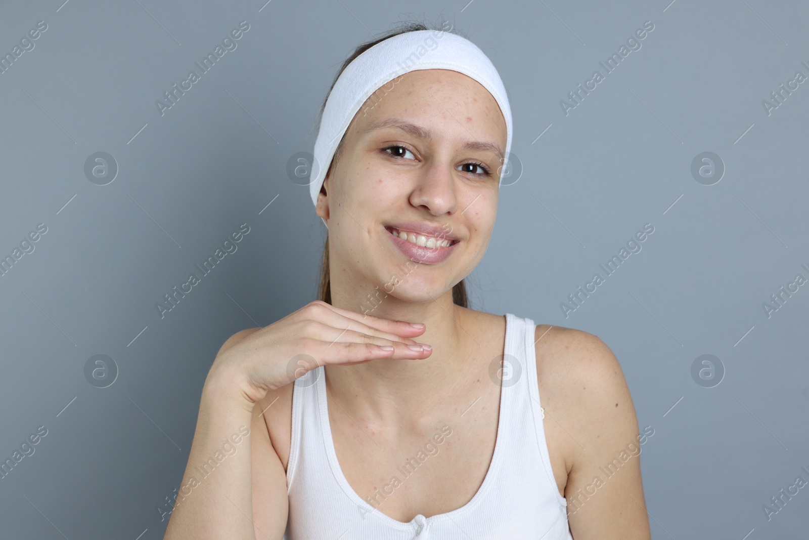 Photo of Teenage girl with acne problem on grey background