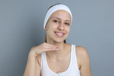 Photo of Teenage girl with acne problem on grey background