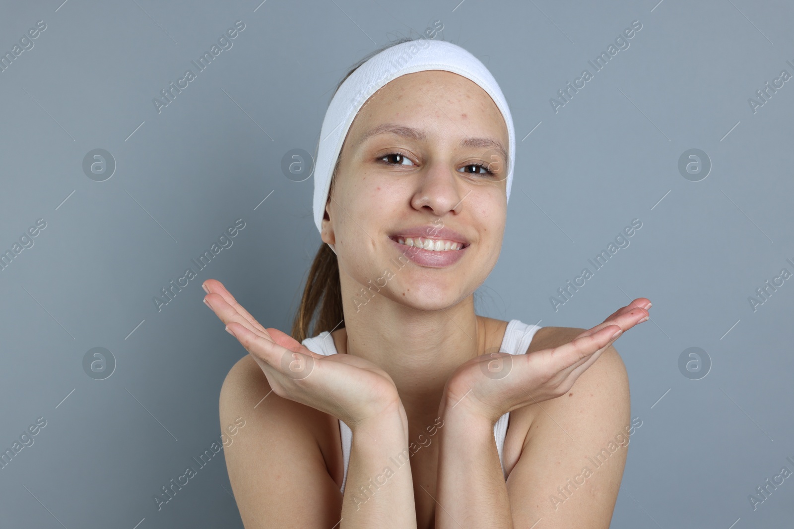 Photo of Teenage girl with acne problem on grey background