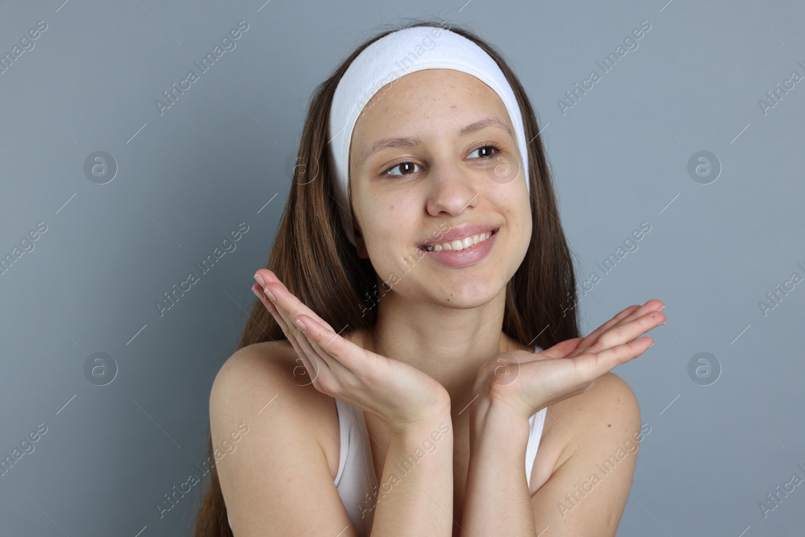 Photo of Teenage girl with acne problem on grey background