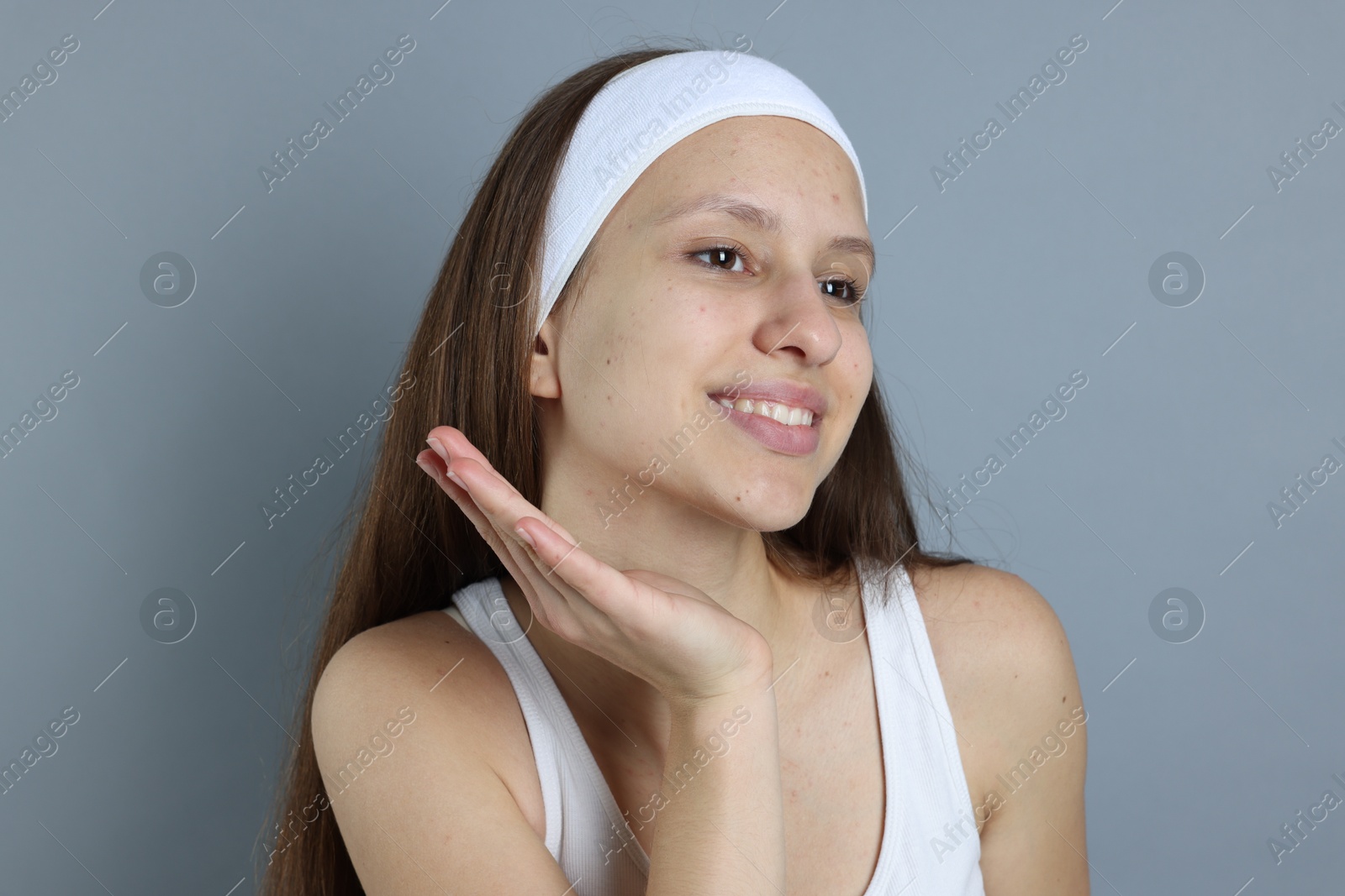 Photo of Teenage girl with acne problem on grey background