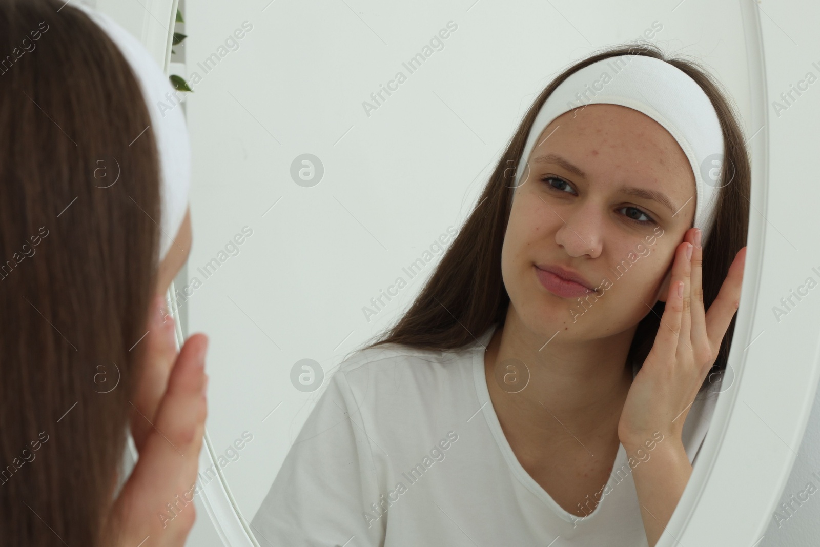 Photo of Teenage girl with acne problem looking in mirror indoors