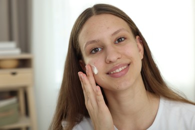 Photo of Teenage girl applying cream onto face at home. Acne treatment