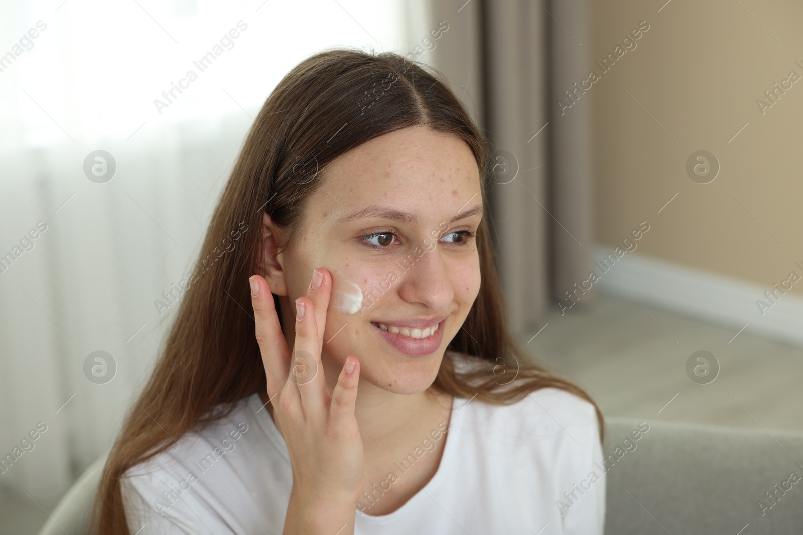 Photo of Teenage girl applying cream onto face at home. Acne treatment