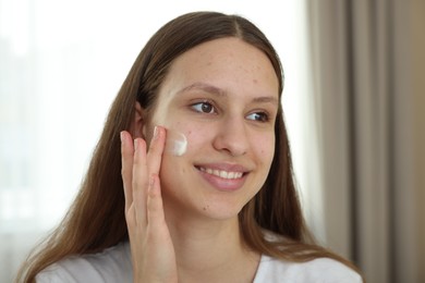 Photo of Teenage girl applying cream onto face at home. Acne treatment