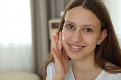 Photo of Teenage girl applying cream onto face at home, space for text. Acne treatment