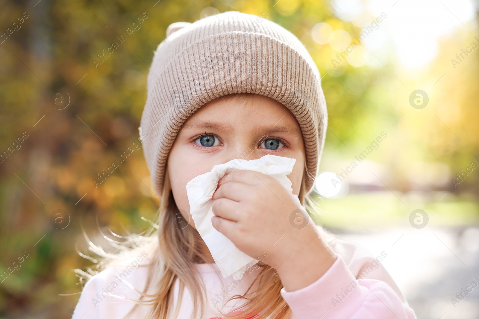 Photo of Little girl with runny nose in park