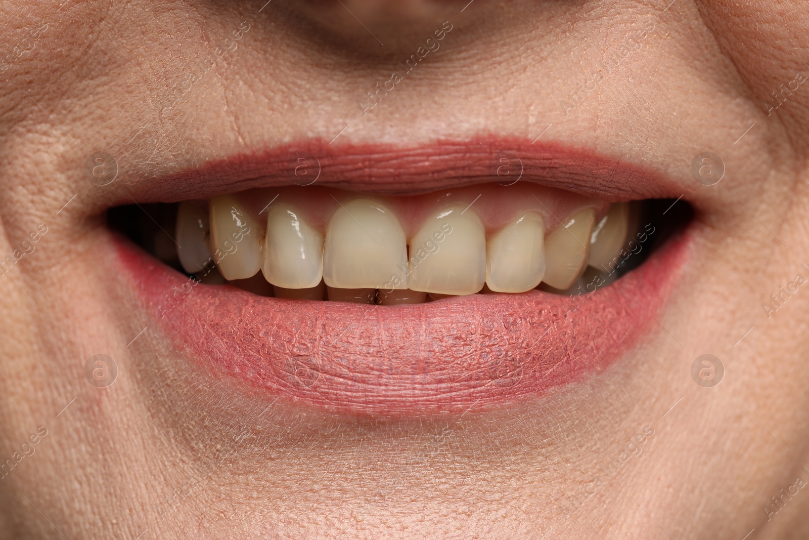 Photo of Woman smiling with her teeth, closeup view