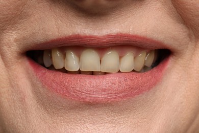 Woman smiling with her teeth, closeup view