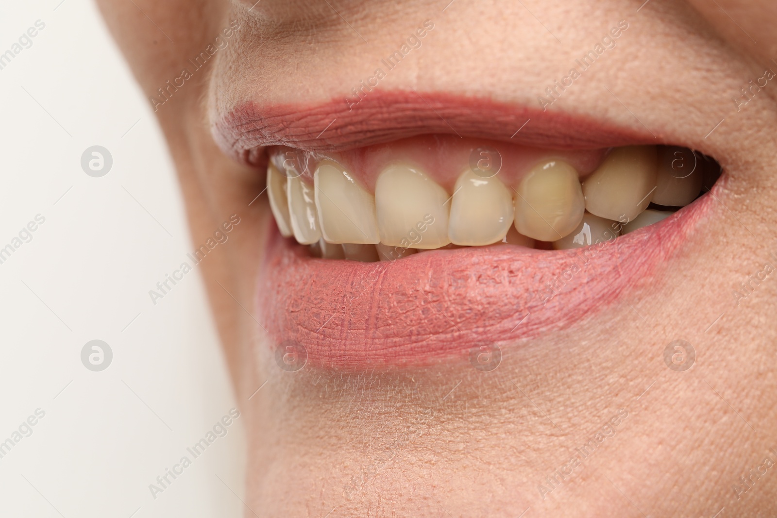 Photo of Woman smiling with her teeth on white background, closeup