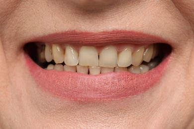 Woman smiling with her teeth, closeup view